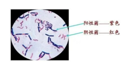 豬病毒性疾病與細(xì)菌性疾病常見病的區(qū)分-上海邦森